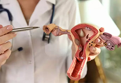 PCOS